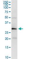 Anti-PRSS21 Rabbit Polyclonal Antibody