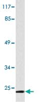 Anti-CTSG Rabbit Polyclonal Antibody