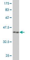 Anti-PUM2 Mouse Monoclonal Antibody [clone: 7C7]