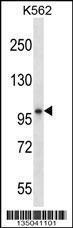 Anti-KEL Rabbit Polyclonal Antibody (AP (Alkaline Phosphatase))