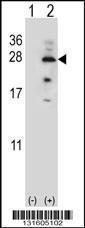 Anti-IL17B Rabbit Polyclonal Antibody (AP (Alkaline Phosphatase))