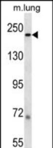 Anti-LAMB1 Rabbit Polyclonal Antibody (HRP (Horseradish Peroxidase))