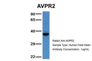 Anti-AVPR2 Rabbit Polyclonal Antibody