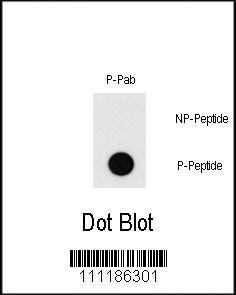 Anti-MEF2C Rabbit Polyclonal Antibody (AP (Alkaline Phosphatase))