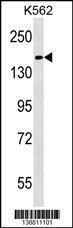 Anti-HEPHL1 Rabbit Polyclonal Antibody (Biotin)