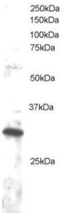 Anti-DKK4 Antibody (A83819) staining (1µg/ml) of Jurkat lysate (RIPA buffer, 30µg total protein per lane). Primary incubated for 1 hour. Detected by western blot using chemiluminescence.