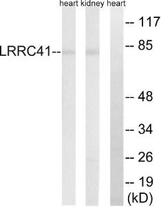 Western blot analysis of lysates from rat kidney and rat heart cells using Anti-LRRC41 Antibody. The right hand lane represents a negative control, where the antibody is blocked by the immunising peptide