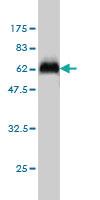 Anti-STK16 Mouse Monoclonal Antibody [clone: M2]