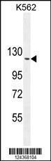 Anti-ARHGAP17 Rabbit Polyclonal Antibody (HRP (Horseradish Peroxidase))