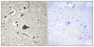 Immunohistochemical analysis of paraffin-embedded human brain using Anti-TNF12 Antibody. The right hand panel represents a negative control, where the antibody was pre-incubated with the immunising peptide.