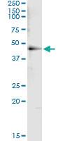 Anti-HDAC8 Mouse Monoclonal Antibody [clone: 2F4]