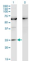 Anti-KCNIP1 Mouse Monoclonal Antibody [clone: 3D9]