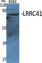 Western blot analysis of various cells using Anti-LRRC41 Antibody