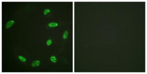 Antibody anti-ERF A98524-100 100 µg