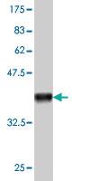 Anti-ACOT11 Mouse Monoclonal Antibody [clone: 4D1]