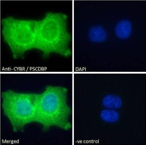 Anti-Cytohesin 1 Antibody (A83821) - Immunofluorescence analysis of paraformaldehyde fixed A431 cells, permeabilized with 0.15% Triton. Primary incubation 1hr (10µg/ml) followed by Alexa Fluor 488 secondary antibody (2µg/ml), showing cytoplasmic and nuclear staining.