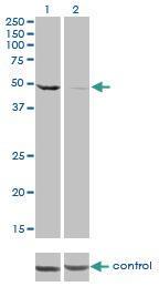 Anti-DDX6 Mouse monoclonal antibody [clone: 10B2681]