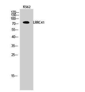 Western blot analysis of K562 cells using Anti-LRRC41 Antibody