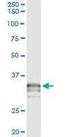 Anti-PRSS21 Mouse Monoclonal Antibody [clone: 2E10]