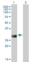 Anti-APOA1 Mouse Polyclonal Antibody