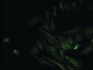 Anti-ODF2 Mouse Monoclonal Antibody [clone: 1A1]