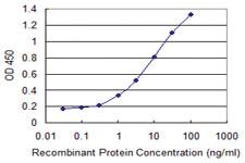 Anti-KCNIP1 Mouse Monoclonal Antibody [clone: 3D9]