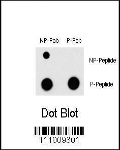 Anti-MEF2C Rabbit Polyclonal Antibody (AP (Alkaline Phosphatase))