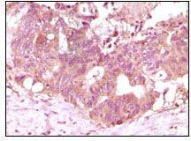 Anti-FGF2 Mouse Monoclonal Antibody [clone: 13B300]