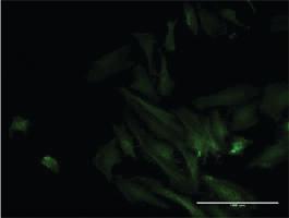 Anti-ODF2 Mouse Monoclonal Antibody [clone: 1A1]