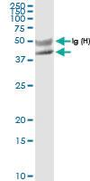 Anti-FANCL Rabbit Polyclonal Antibody