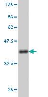 Anti-NVL Mouse Monoclonal Antibody [clone: 3F6]