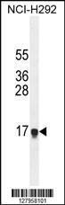 Anti-HEPN1 Rabbit Polyclonal Antibody (FITC (Fluorescein Isothiocyanate))