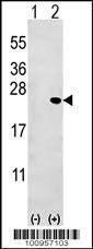 Anti-BID Rabbit Polyclonal Antibody (FITC (Fluorescein Isothiocyanate))