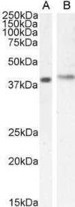 Anti-Cytohesin 1 Antibody (A83821) (0.5µg/ml) staining of Jurkat (A) and (1µg/ml) MOLT4 (B) cell lysate (35µg protein in RIPA buffer). Detected by chemiluminescence.