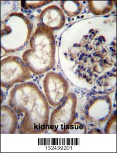 Anti-MBTPS2 Rabbit Polyclonal Antibody (HRP (Horseradish Peroxidase))