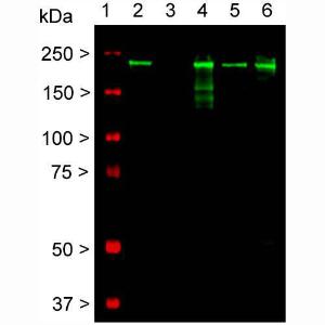 Western blot detection of the heavily phosphorylated axonal form of NF-H protein (pNF-H) in neural tissue lysates (20 µg/lane) with Anti-Neurofilament Heavy Polypeptide Antibody [AH1] (A85340) at dilution of 1:5,000