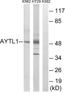 Western blot analysis of lysates from K562 and HT-29 cells using Anti-LPCAT2 Antibody. The right hand lane represents a negative control, where the antibody is blocked by the immunising peptide.