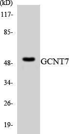 Western blot analysis of the lysates from HT 29 cells using Anti-GCNT7 Antibody