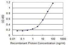 Anti-HDAC8 Mouse Monoclonal Antibody [clone: 2F4]