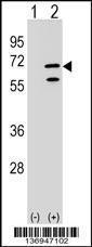 Anti-POLR3C Rabbit Polyclonal Antibody (Biotin)