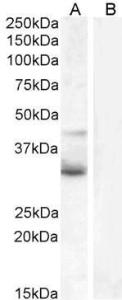 Anti-WNT4 Antibody (A83822) (1µg/ml) staining of Jurkat (A) and negative control U937 (B) cell lysate (35µg protein in RIPA buffer). Detected by chemiluminescence.