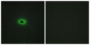 Immunofluorescence analysis of HeLa cells using Anti-TNF12 Antibody. The right hand panel represents a negative control, where the antibody was pre-incubated with the immunising peptide.