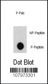 Anti-ABL1 Rabbit Polyclonal Antibody