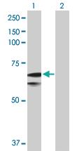 Anti-SLC27A1 Rabbit Polyclonal Antibody