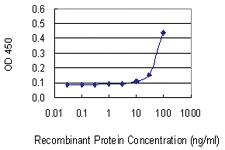 Anti-PRSS21 Mouse Monoclonal Antibody [clone: 2E10]