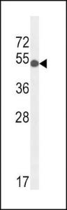 Anti-GPI Rabbit Polyclonal Antibody (PE (Phycoerythrin))