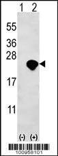 Anti-BID Rabbit Polyclonal Antibody (FITC (Fluorescein Isothiocyanate))