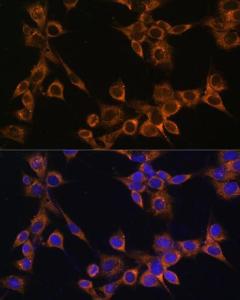 Anti-RAMP1 Rabbit Polyclonal Antibody