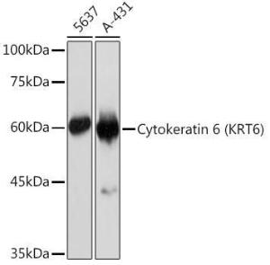 Western blot analysis of extracts of various cell lines, using Anti-Cytokeratin 6c Antibody [ARC2352] (A309251) at 1:1,000 dilution The secondary antibody was Goat Anti-Rabbit IgG H&L Antibody (HRP) at 1:10,000 dilution Lysates/proteins were present at 25 µg per lane