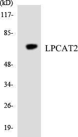 Western blot analysis of the lysates from HT 29 cells using Anti-LPCAT2 Antibody